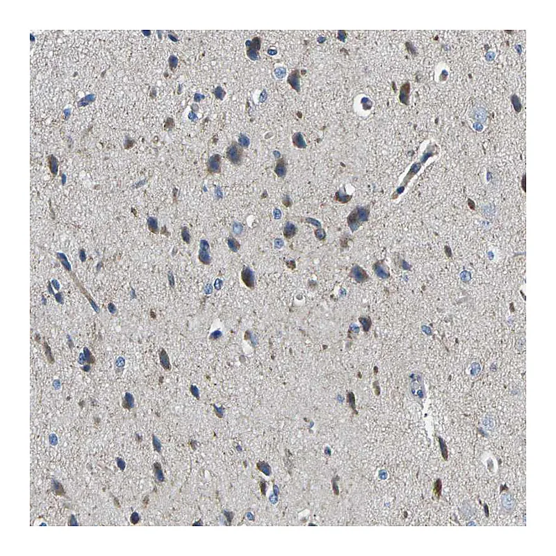 Atlas Antibodies Anti-MC4R Antibody