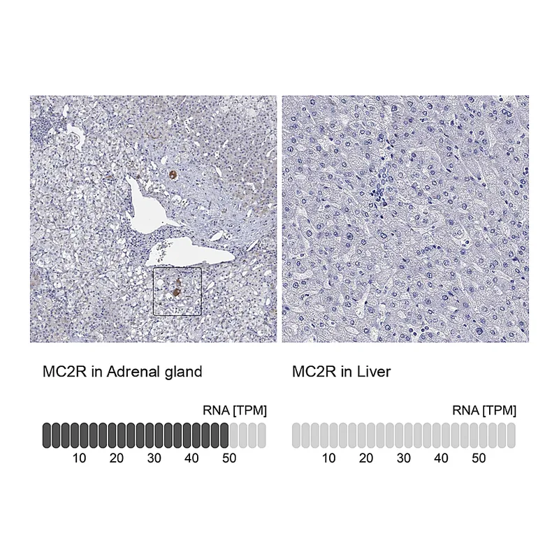 Atlas Antibodies Anti-MC2R Antibody