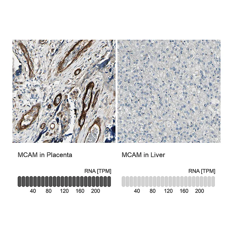 Atlas Antibodies Anti-MCAM Antibody