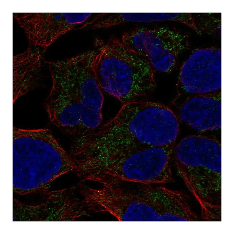 Atlas Antibodies Anti-MCAT Antibody