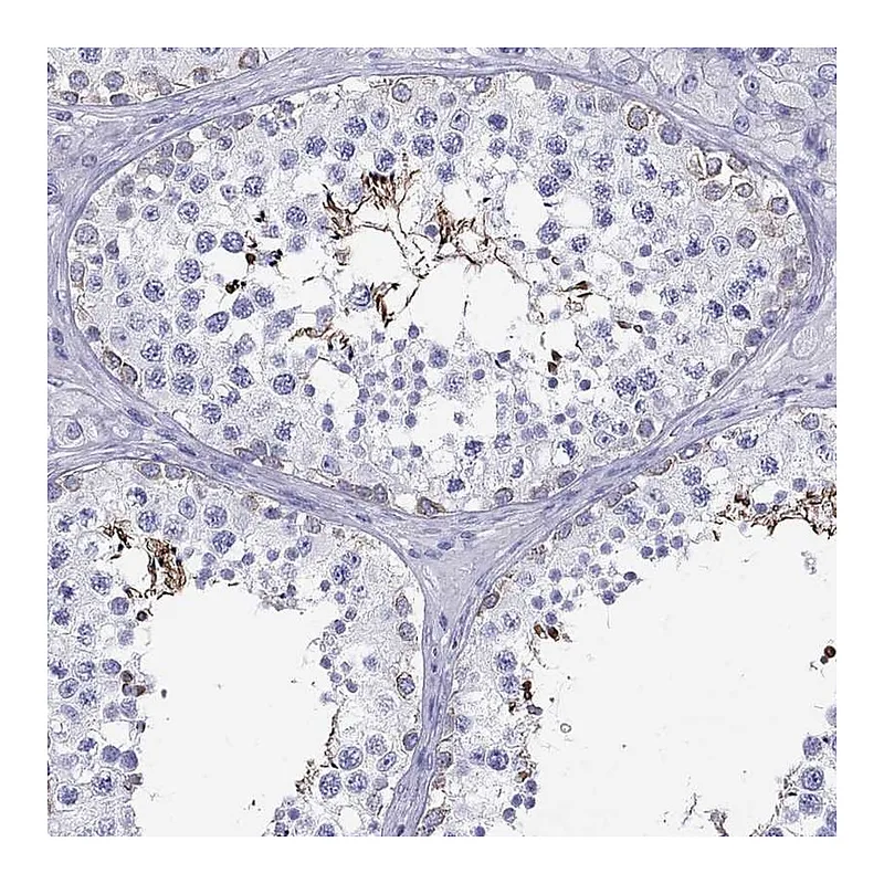 Atlas Antibodies Anti-MC5R Antibody
