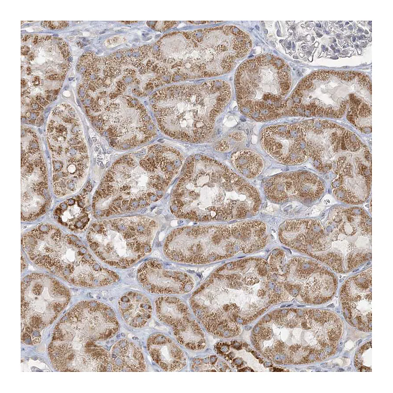 Atlas Antibodies Anti-MCAT Antibody