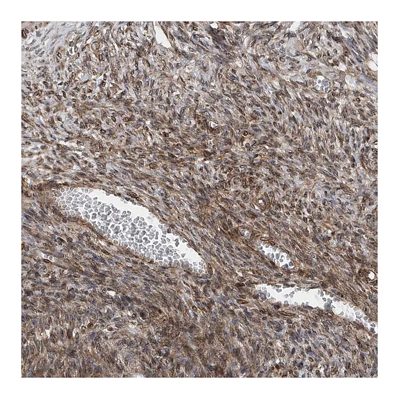 Atlas Antibodies Anti-MCC Antibody