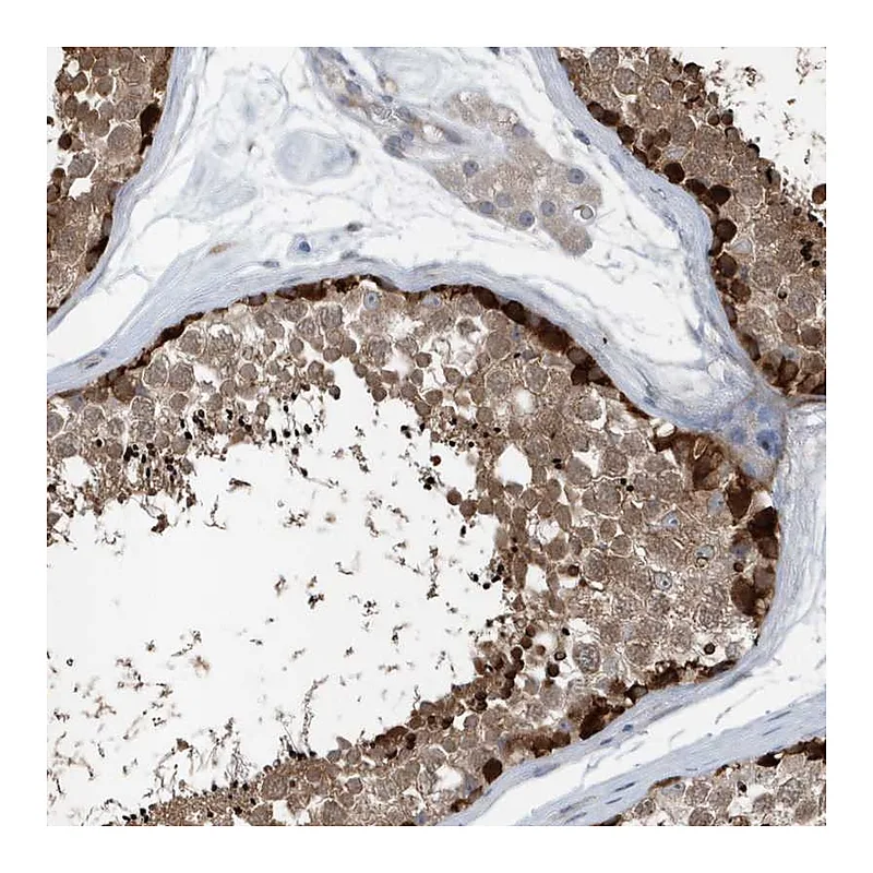 Atlas Antibodies Anti-MCC Antibody