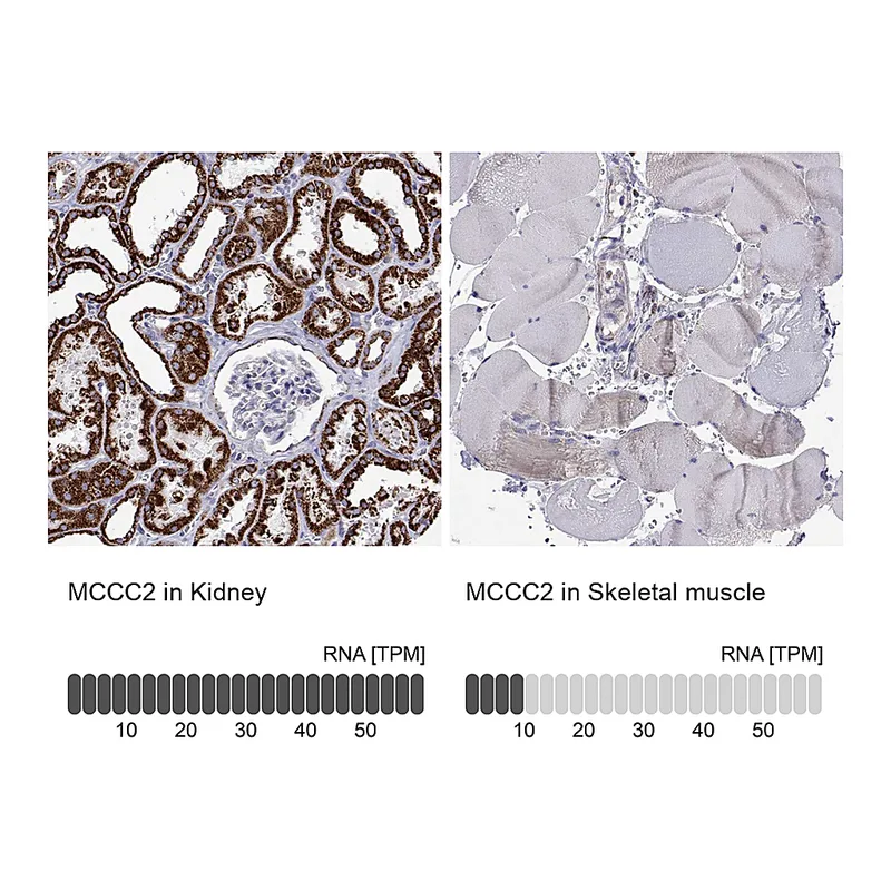 Atlas Antibodies Anti-MCCC2 Antibody