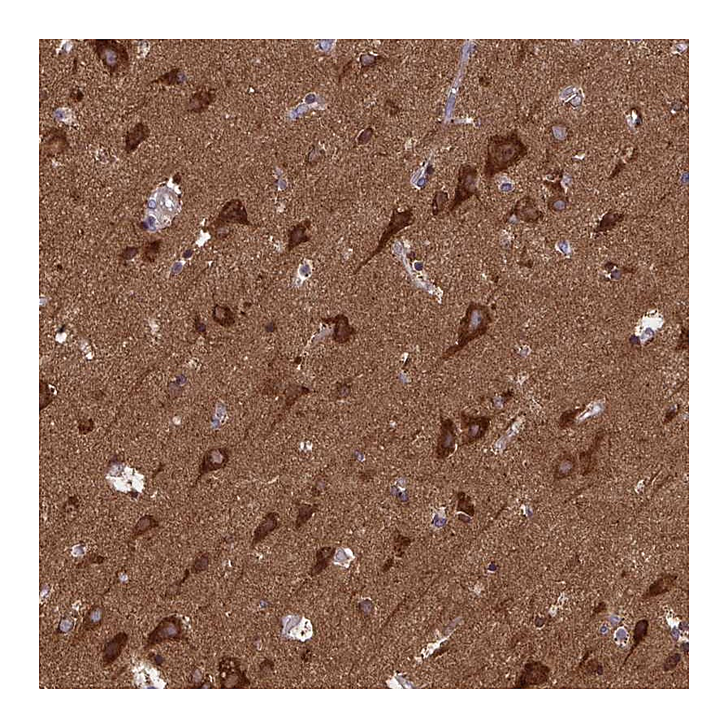 Atlas Antibodies Anti-MCCC1 Antibody