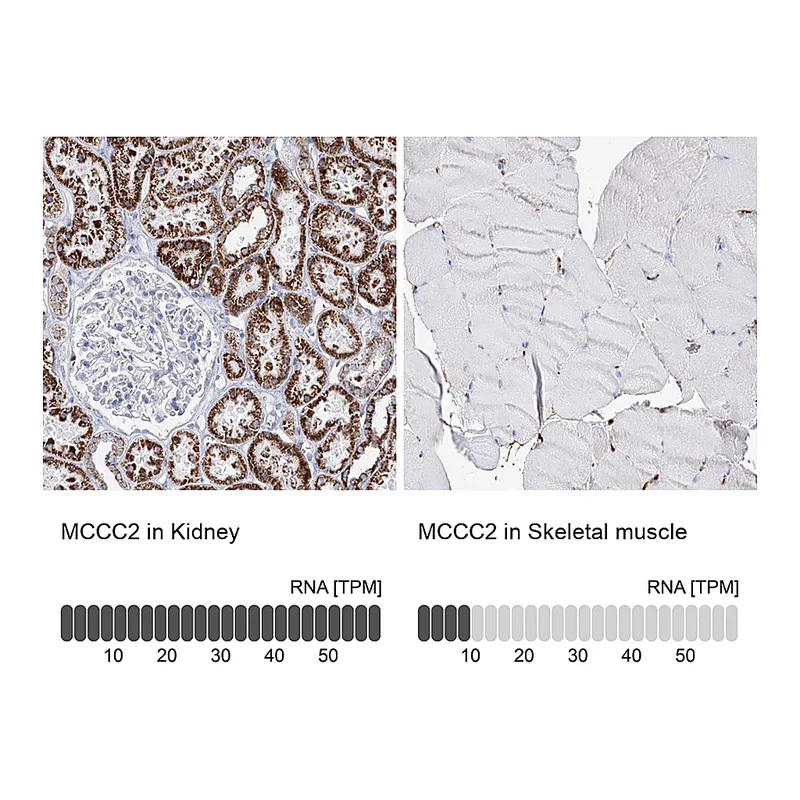 Atlas Antibodies Anti-MCCC2 Antibody