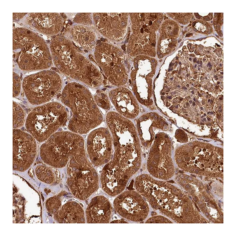 Atlas Antibodies Anti-MCF2L2 Antibody