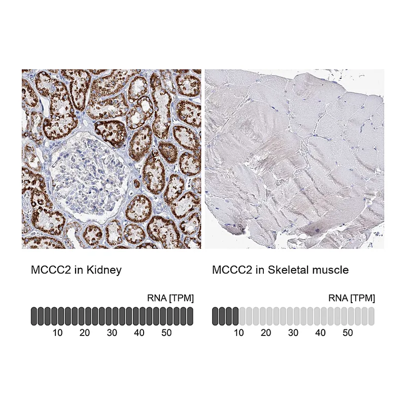 Atlas Antibodies Anti-MCCC2 Antibody