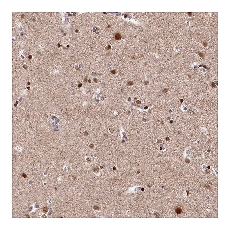Atlas Antibodies Anti-MCF2L2 Antibody