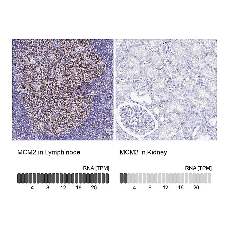 Atlas Antibodies Anti-MCM2 Antibody