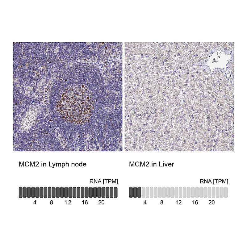 Atlas Antibodies Anti-MCM2 Antibody