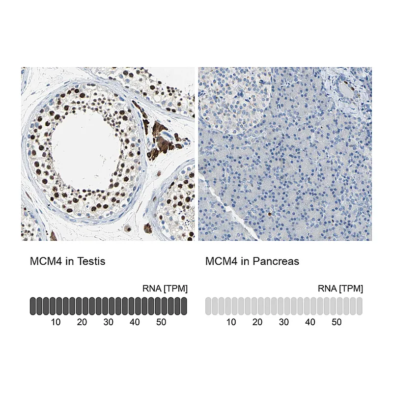 Atlas Antibodies Anti-MCM4 Antibody
