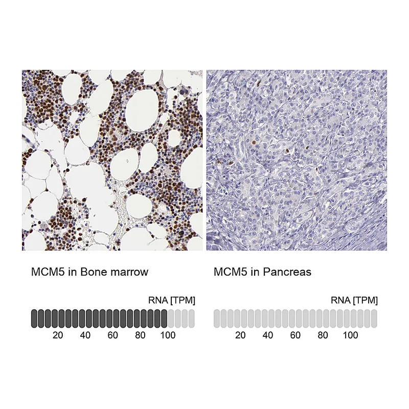 Atlas Antibodies Anti-MCM5 Antibody