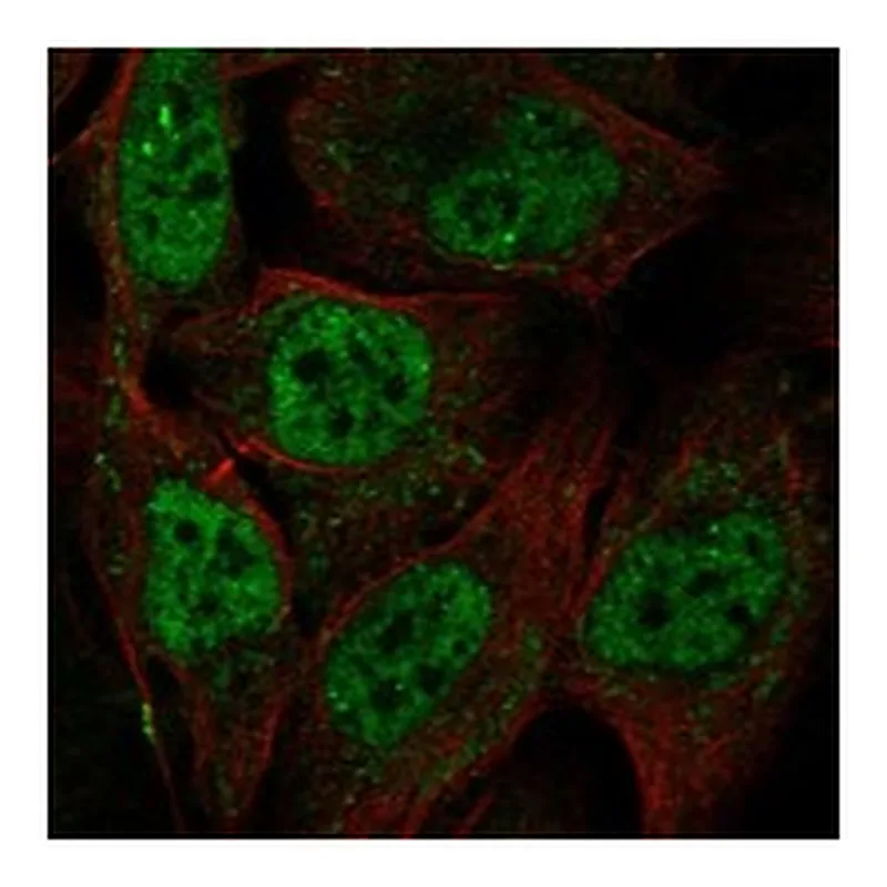 Atlas Antibodies Anti-MCM8 Antibody
