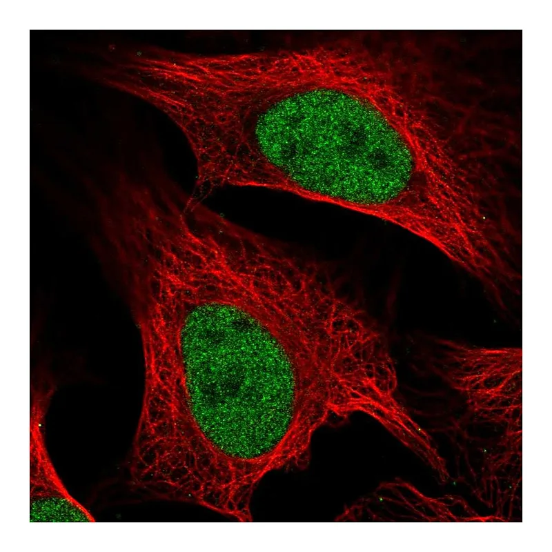Atlas Antibodies Anti-MCM5 Antibody