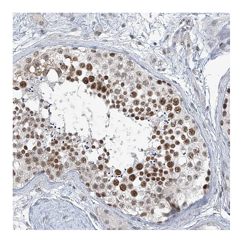 Atlas Antibodies Anti-MCM9 Antibody