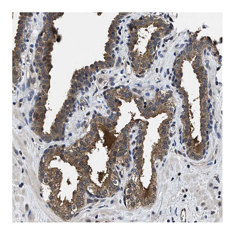 Atlas Antibodies Anti-MCOLN2 Antibody