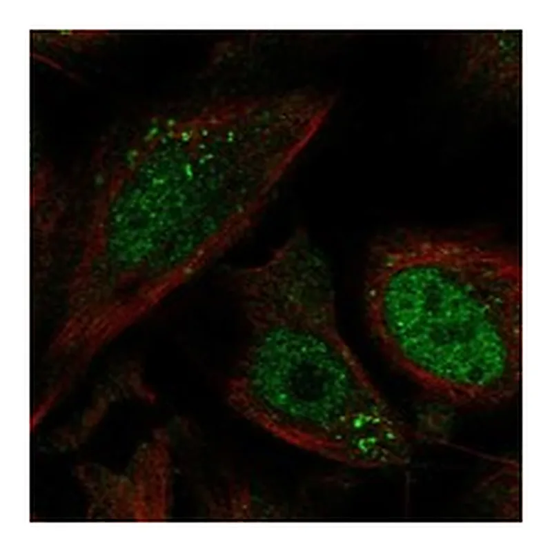 Atlas Antibodies Anti-MCOLN1 Antibody