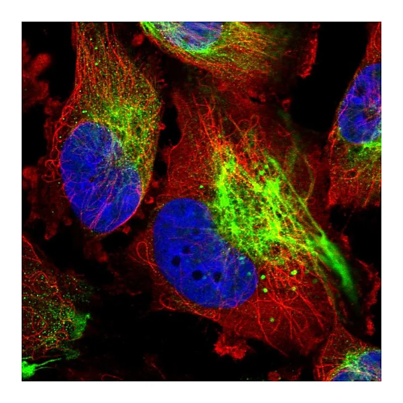 Atlas Antibodies Anti-MCOLN2 Antibody