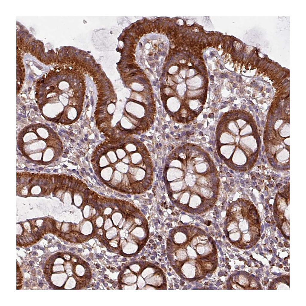 Atlas Antibodies Anti-MCTP2 Antibody