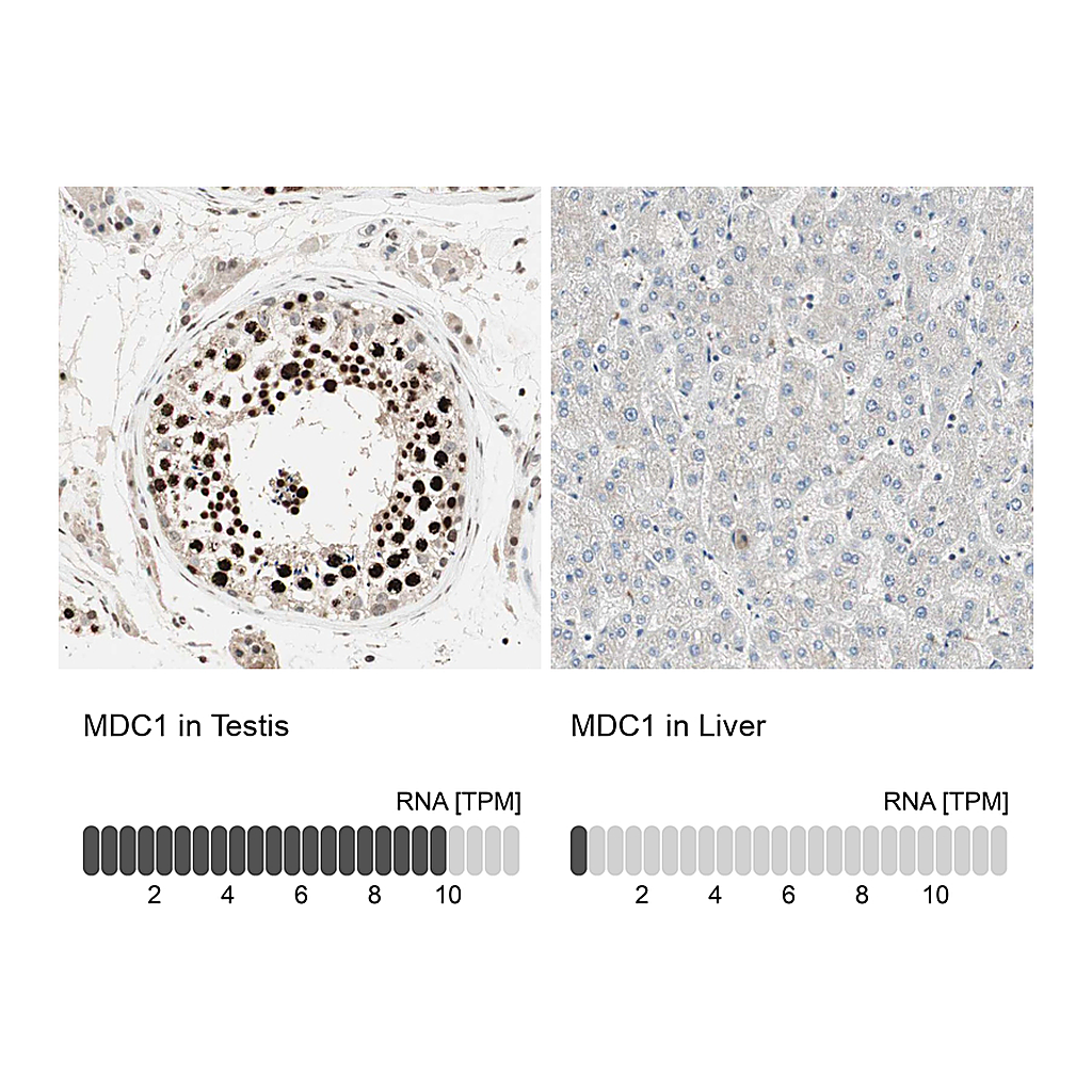 Atlas Antibodies Anti-MDC1 Antibody