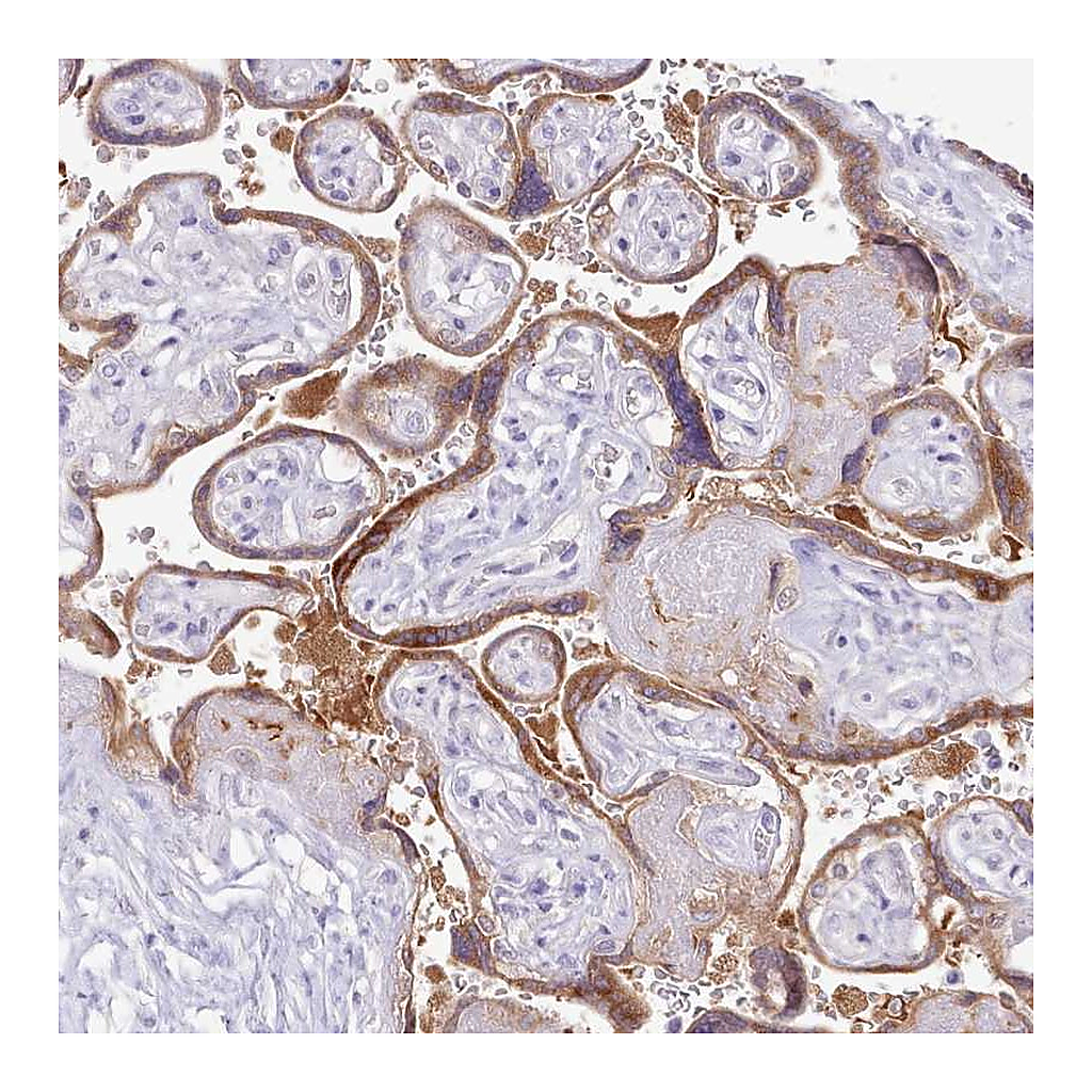 Atlas Antibodies Anti-MDFI Antibody