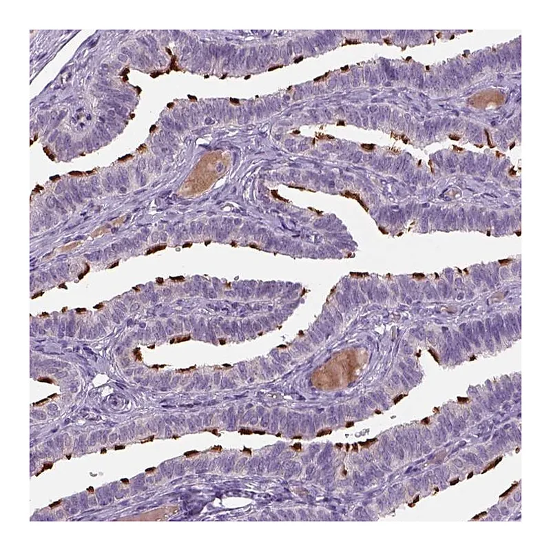 Atlas Antibodies Anti-MDH1B Antibody
