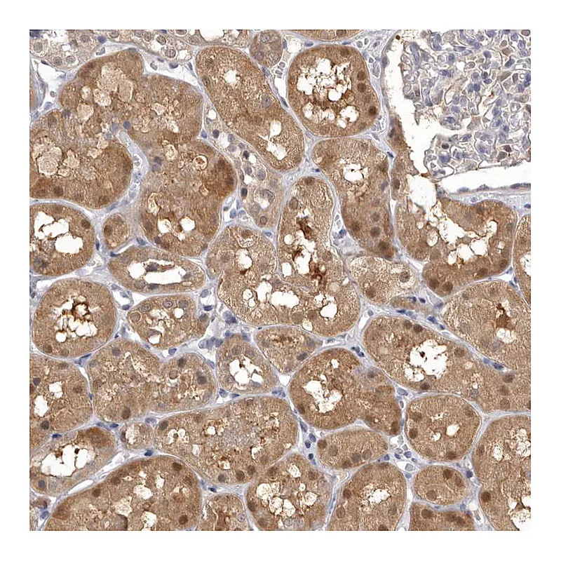 Atlas Antibodies Anti-MDH1 Antibody