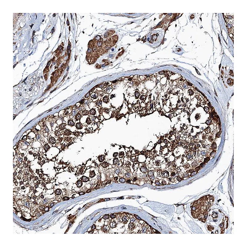 Atlas Antibodies Anti-MDM1 Antibody