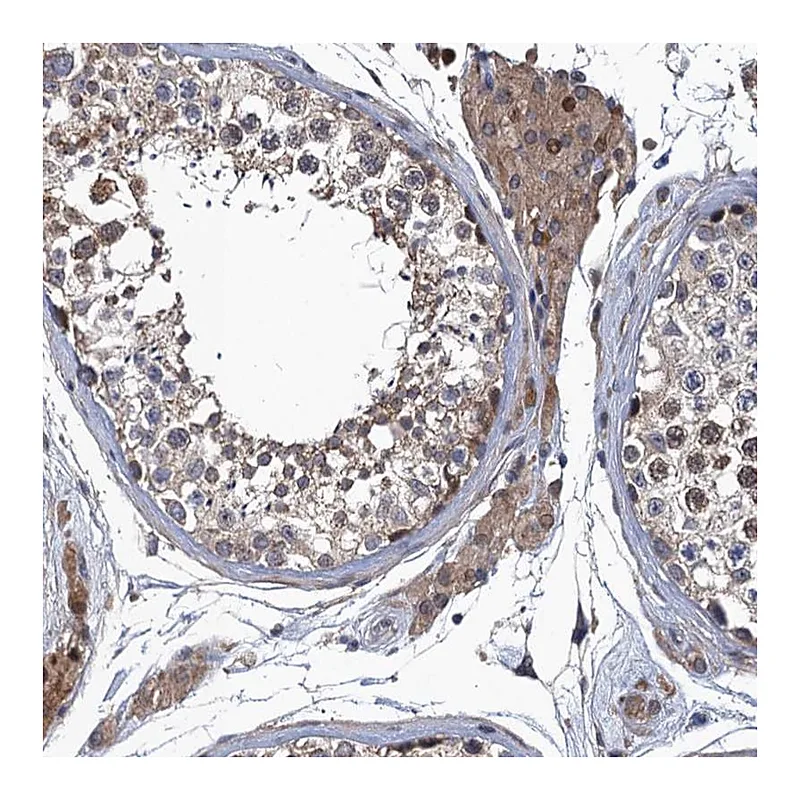 Atlas Antibodies Anti-MDM1 Antibody