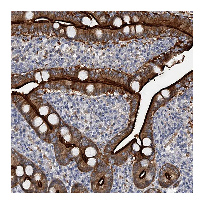 Atlas Antibodies Anti-MDN1 Antibody
