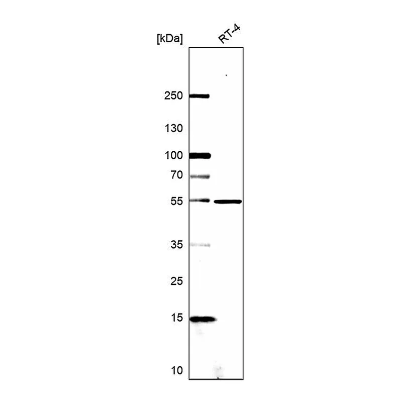 Atlas Antibodies Anti-MDM4 Antibody