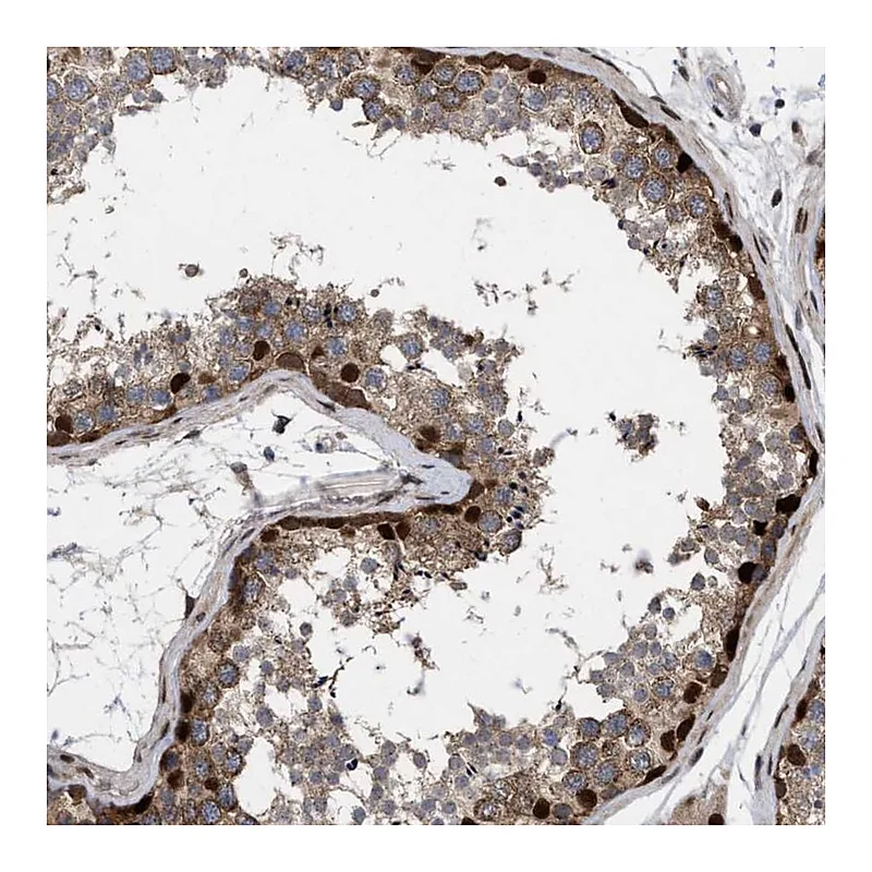 Atlas Antibodies Anti-MDM4 Antibody