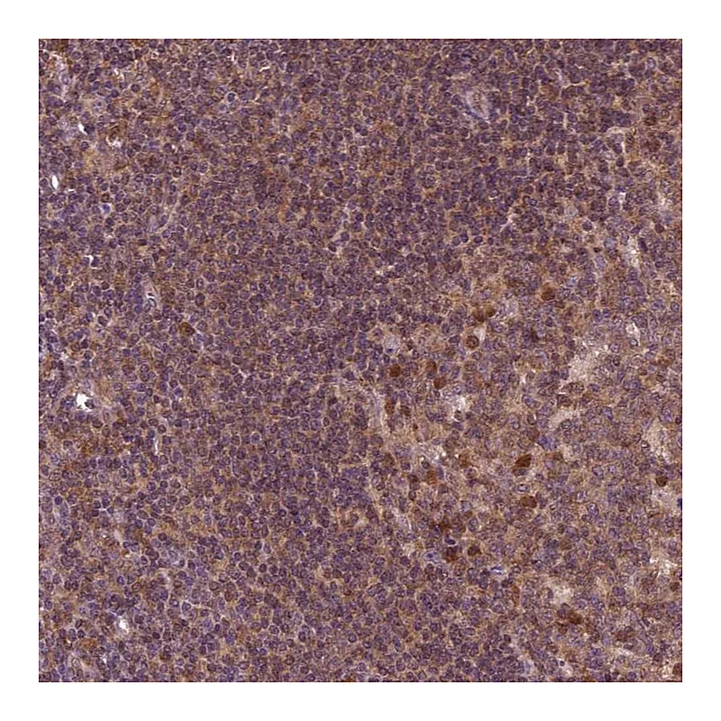 Atlas Antibodies Anti-MDP1 Antibody