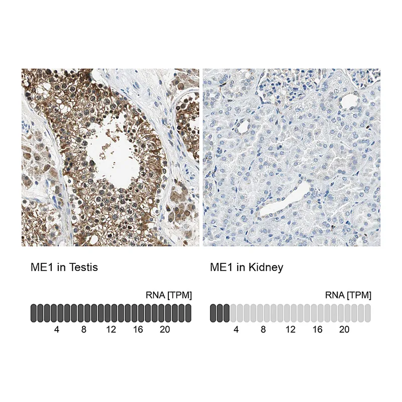 Atlas Antibodies Anti-ME1 Antibody