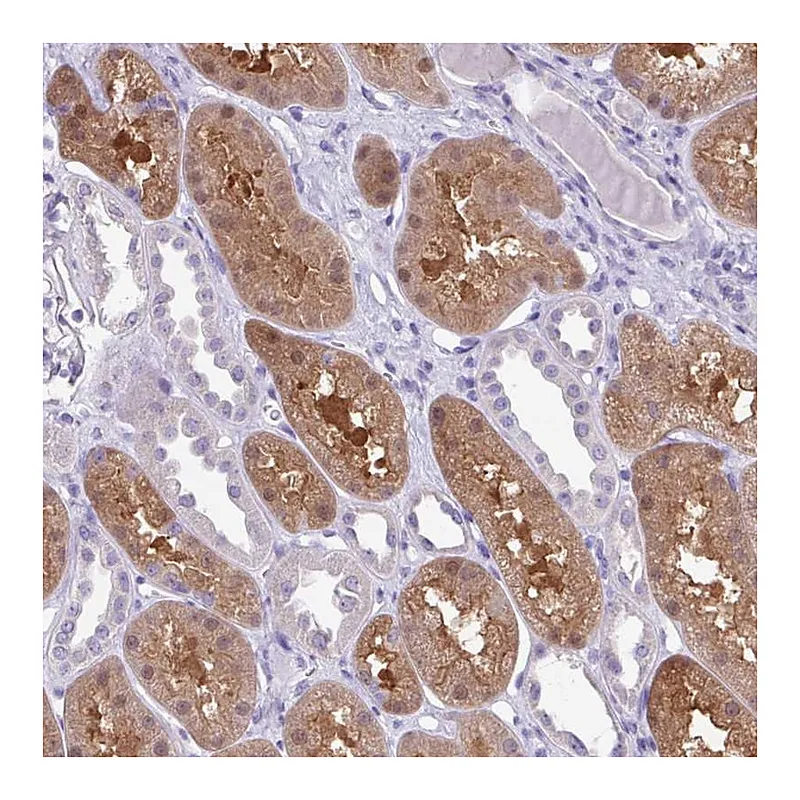 Atlas Antibodies Anti-MDS2 Antibody