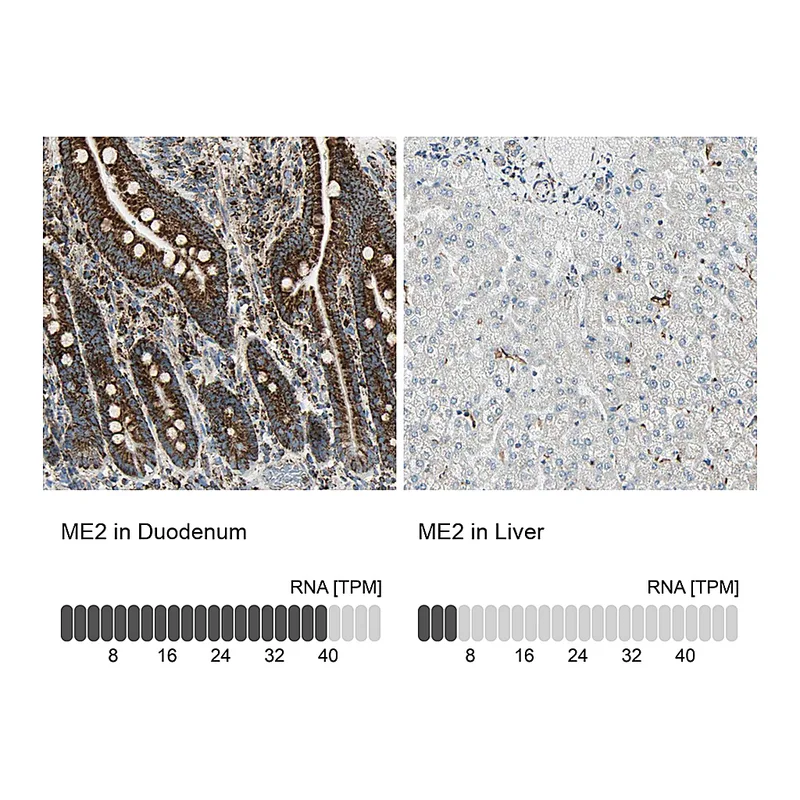 Atlas Antibodies Anti-ME2 Antibody