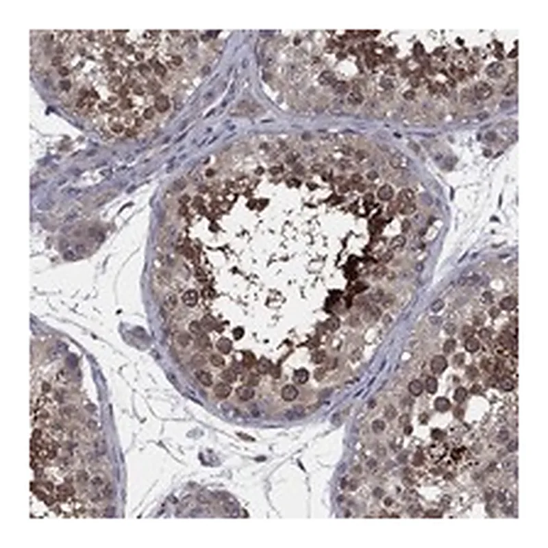 Atlas Antibodies Anti-MEA1 Antibody