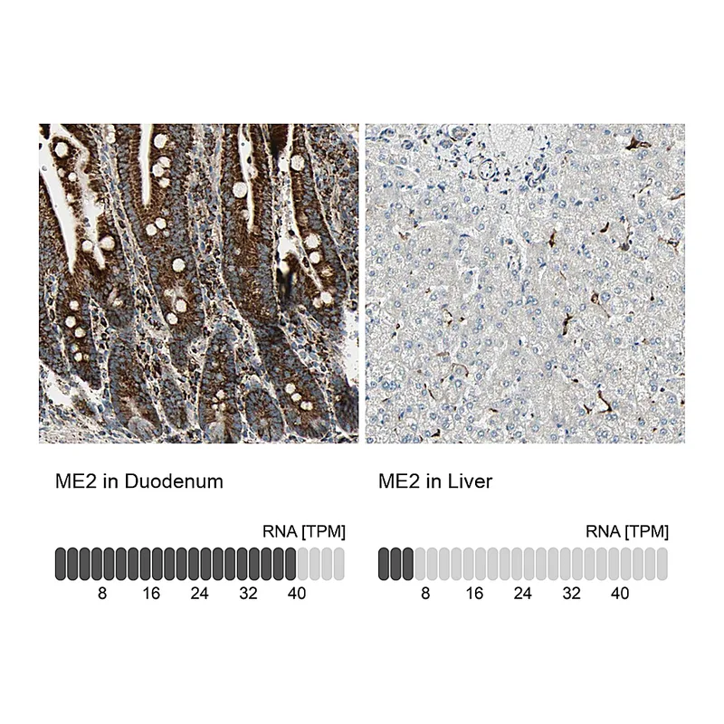 Atlas Antibodies Anti-ME2 Antibody