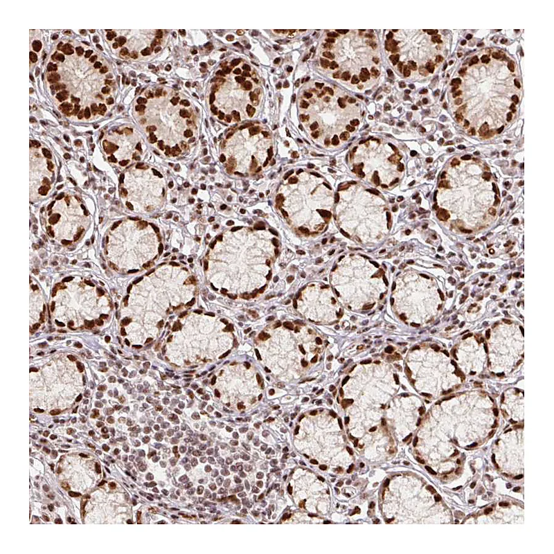 Atlas Antibodies Anti-MECOM Antibody