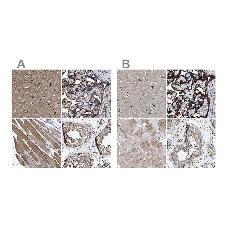 Atlas Antibodies Anti-MECR Antibody