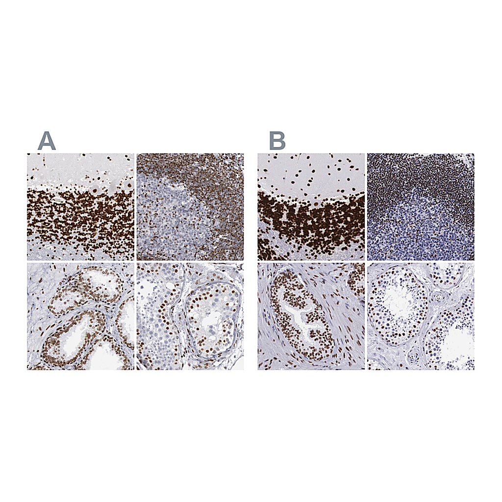 Atlas Antibodies Anti-MECP2 Antibody