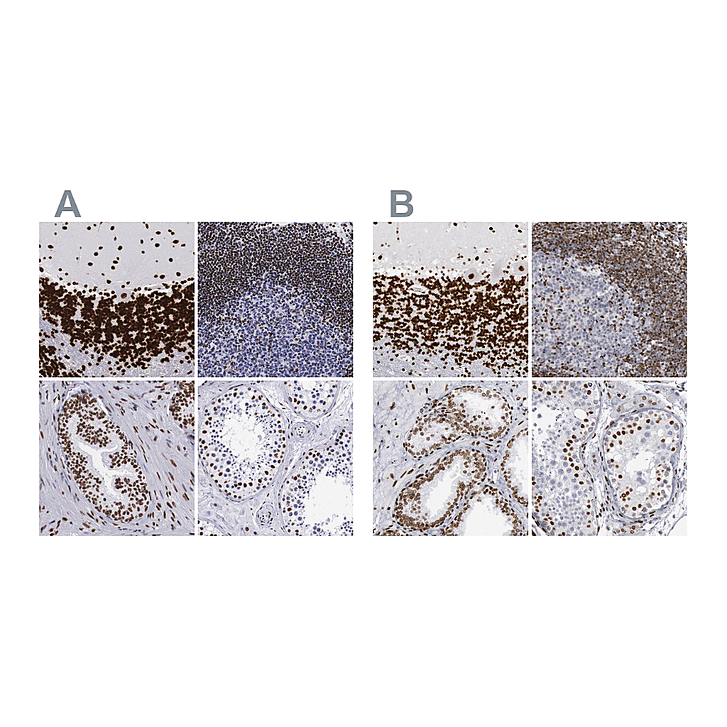 Atlas Antibodies Anti-MECP2 Antibody