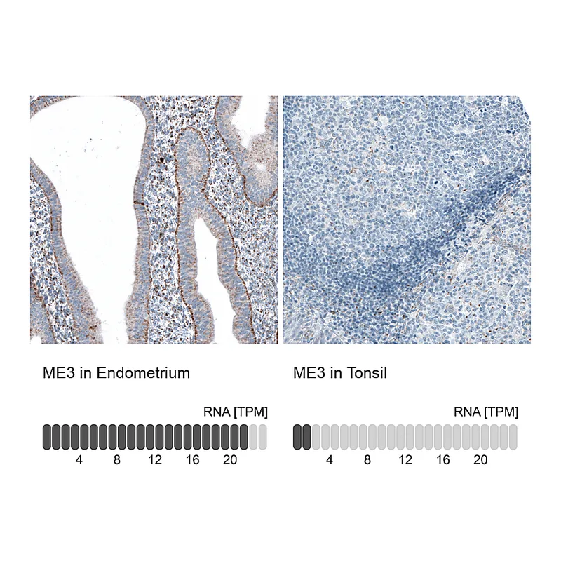 Atlas Antibodies Anti-ME3 Antibody