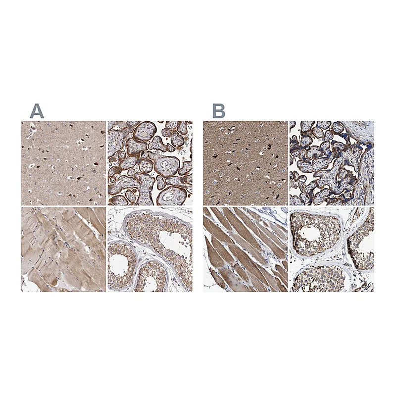 Atlas Antibodies Anti-MECR Antibody