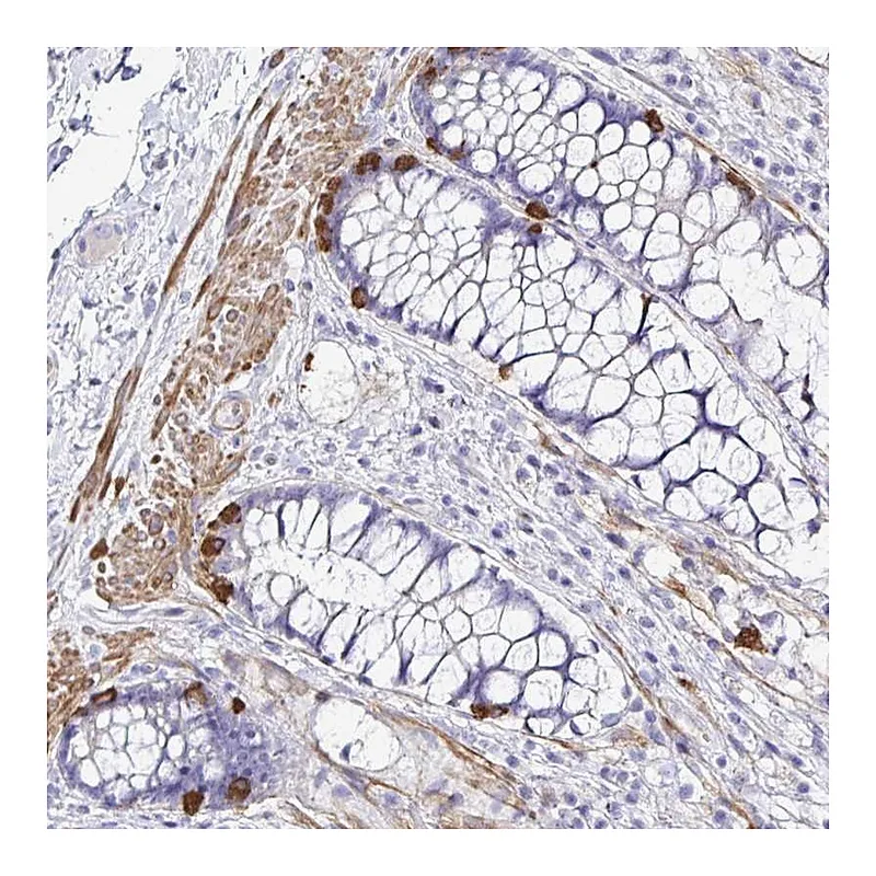 Atlas Antibodies Anti-MED11 Antibody