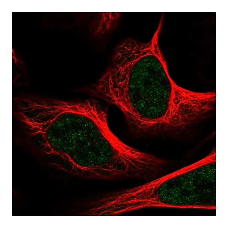 Atlas Antibodies Anti-MED1 Antibody