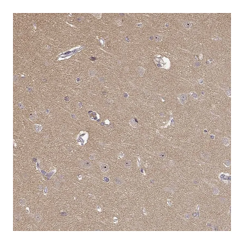 Atlas Antibodies Anti-MED12L Antibody