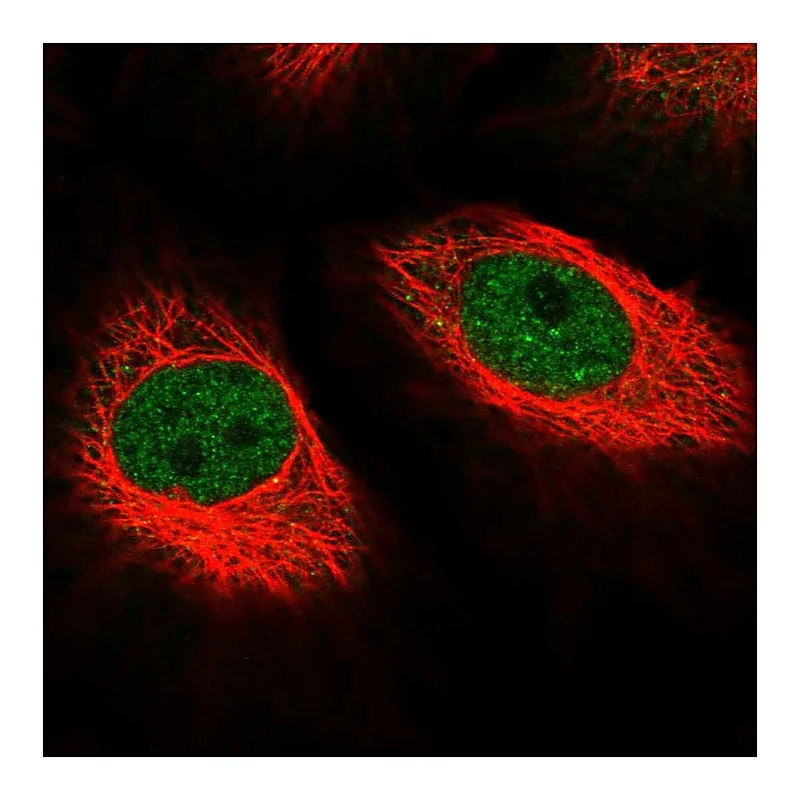 Atlas Antibodies Anti-MED10 Antibody
